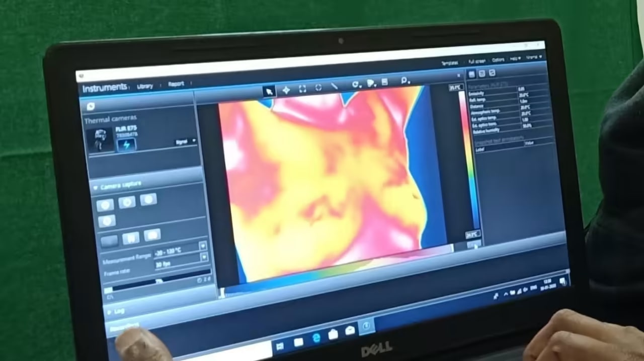 Жасанды интеллект көмегімен сүт безі қатерлі ісігінің диагностикасы