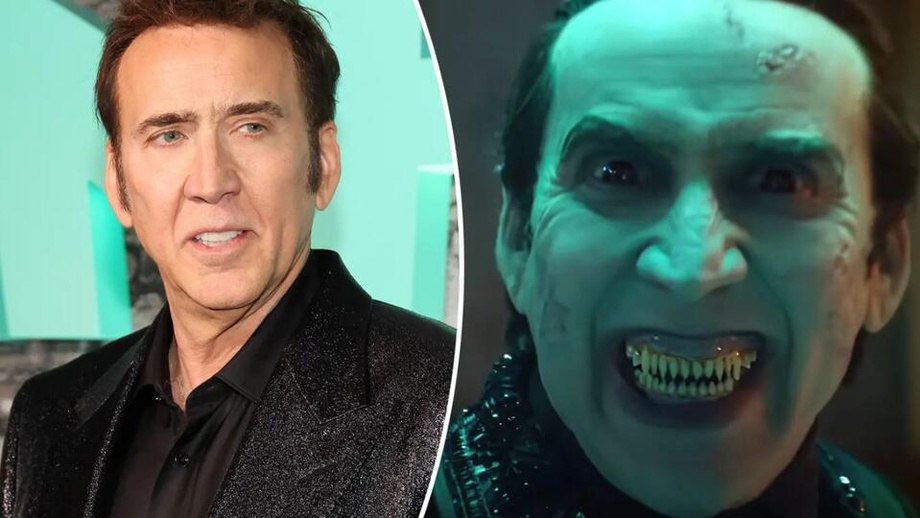 🦹‍♀️Kasbga fidokorlik: Nikolas Keyj rol uchun tishlarini kesib tashladi