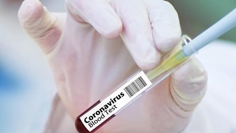 COVID-19 in Azerbaijan: one person dies