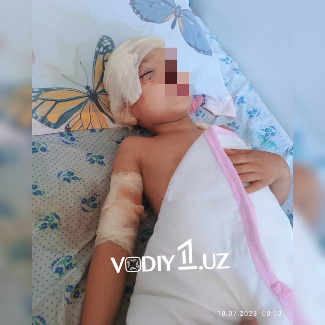 “The child has no signs of collapse. Coming to consciousness, eating independently." In Andijan, a 5-year-old boy who grazed a dog gala was informed