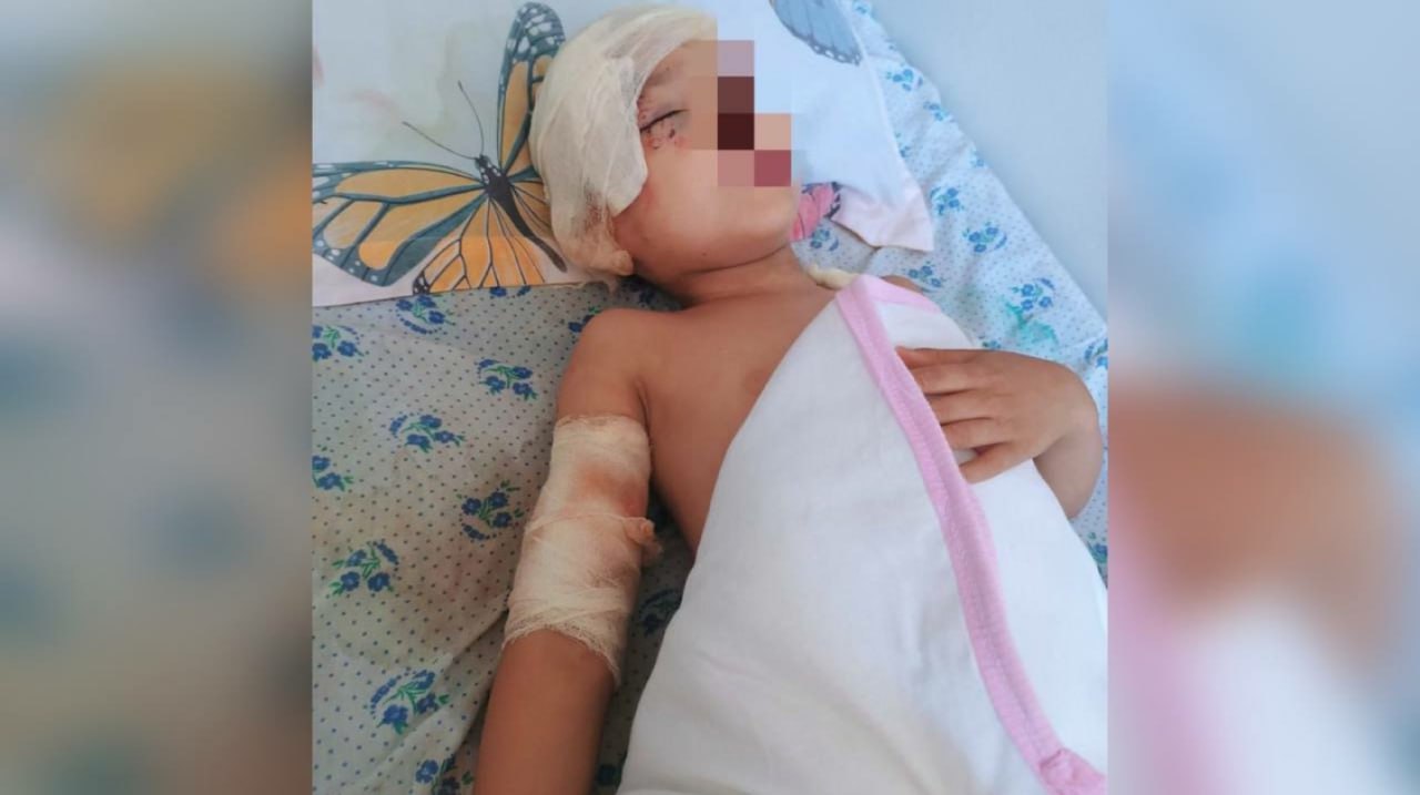 A pack of dogs attacked a 4-year-old boy in Andijan