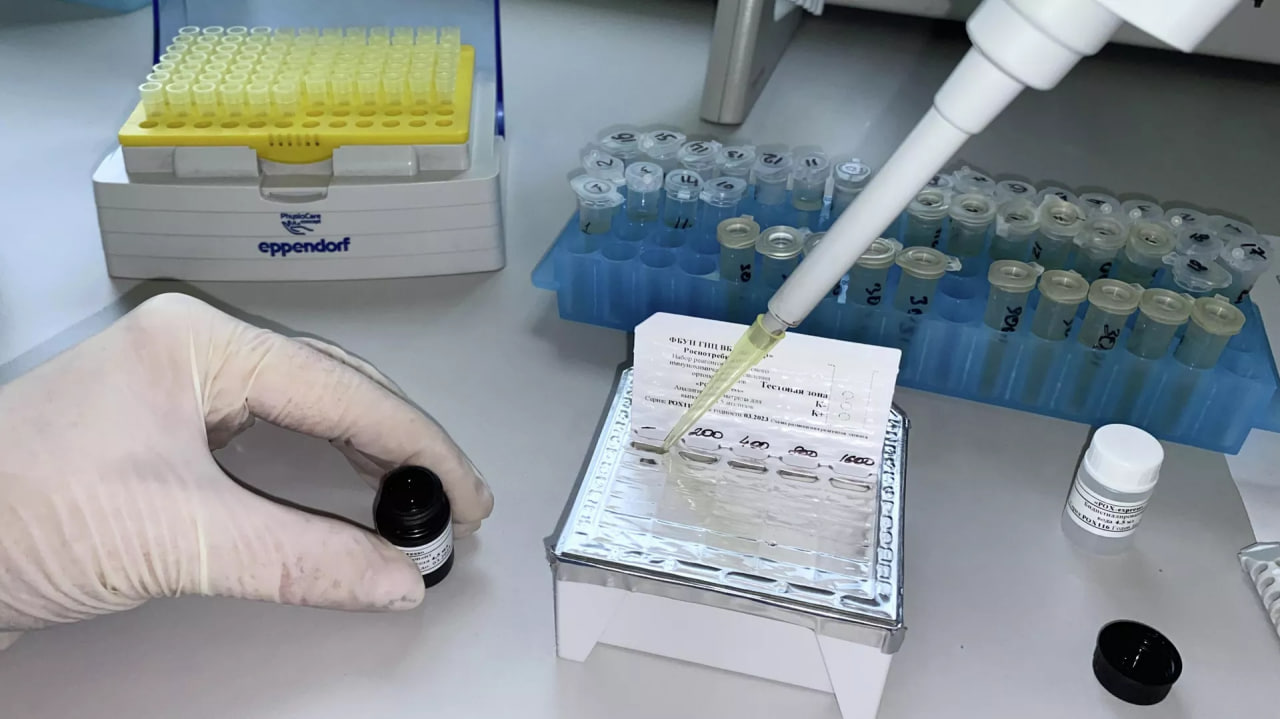Did an unknown Egyptian disease reach Russia? Details