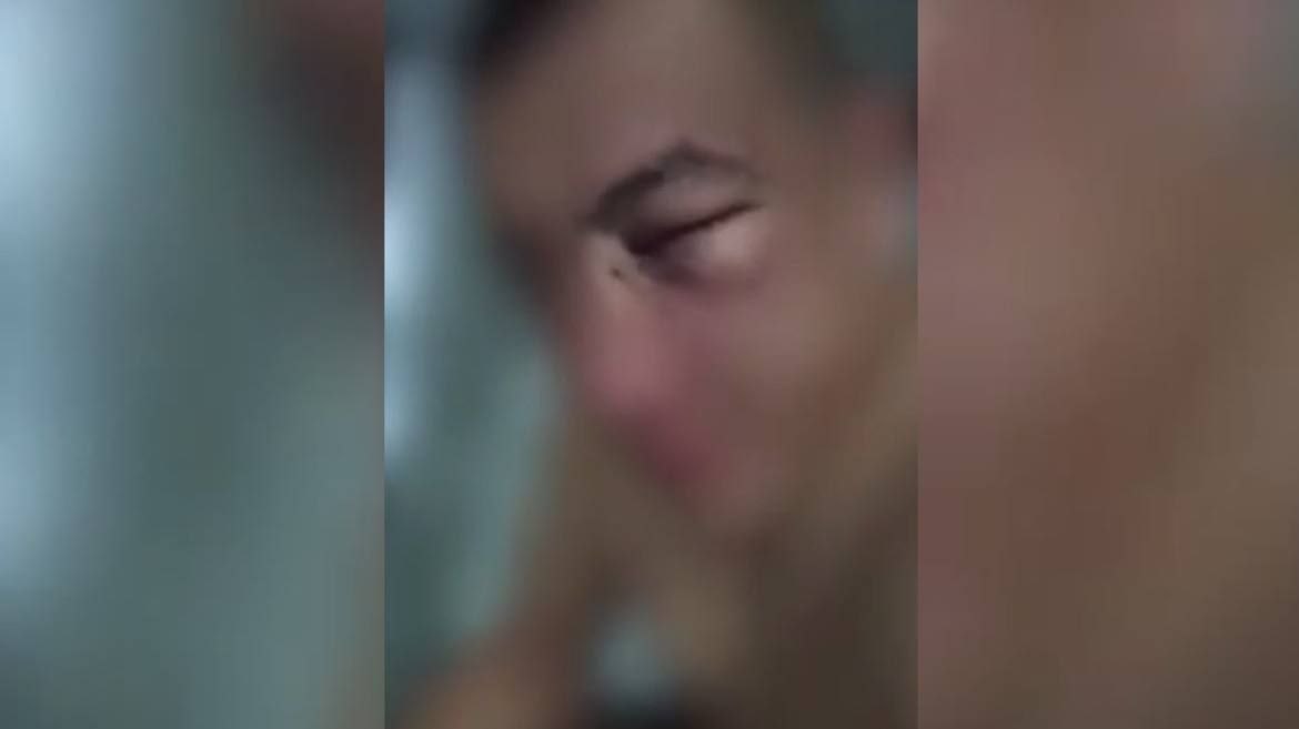 It is said that a bus driver in Tashkent was beaten for coming to work in slippers