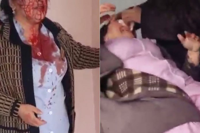 A woman who beat 2 nurses in Samarkand was sentenced