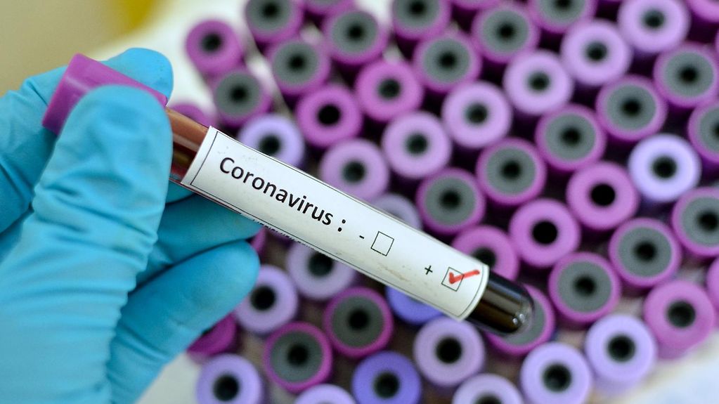 The incidence of COVID-19 in Russia has increased by almost 20 in a week%