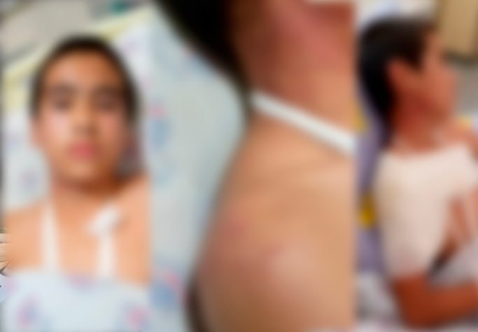 In Fergana, a minor was beaten by a neighbor