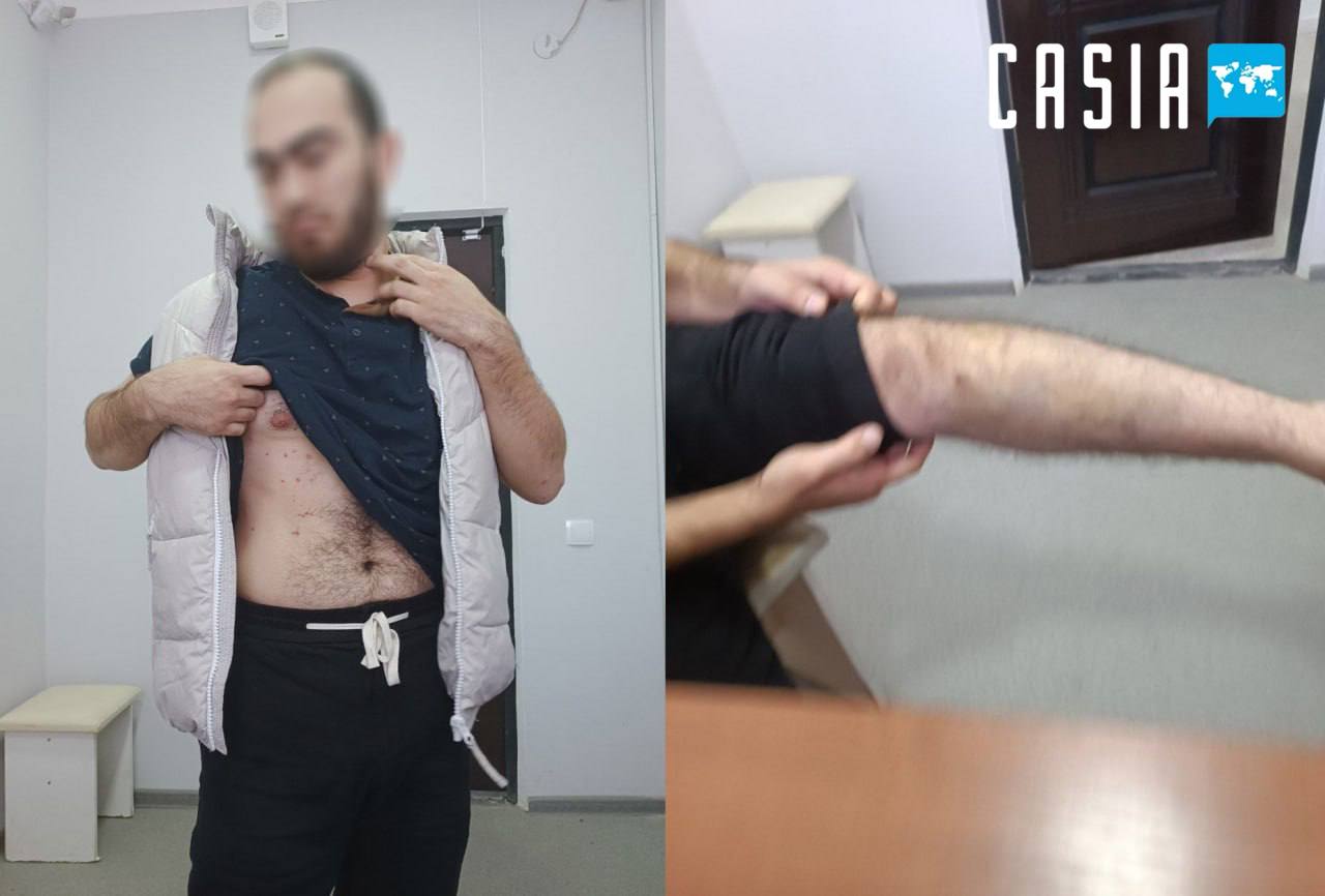 There were reports that customs officials in Tashkent region used force on the suspect