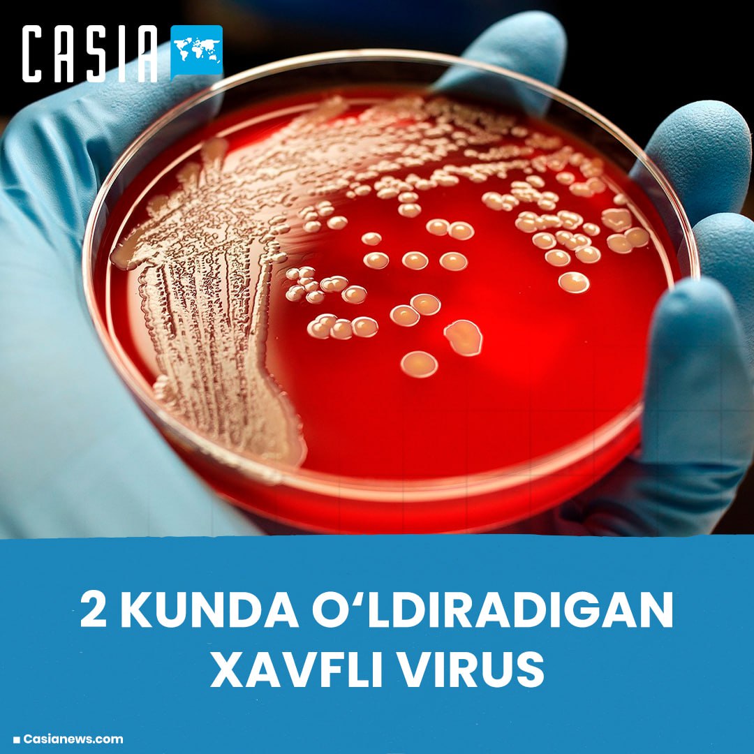 A dangerous virus that kills in 2 days