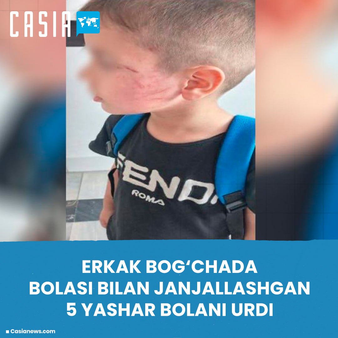 A man beat a 5-year-old boy who quarreled with his child in a kindergarten