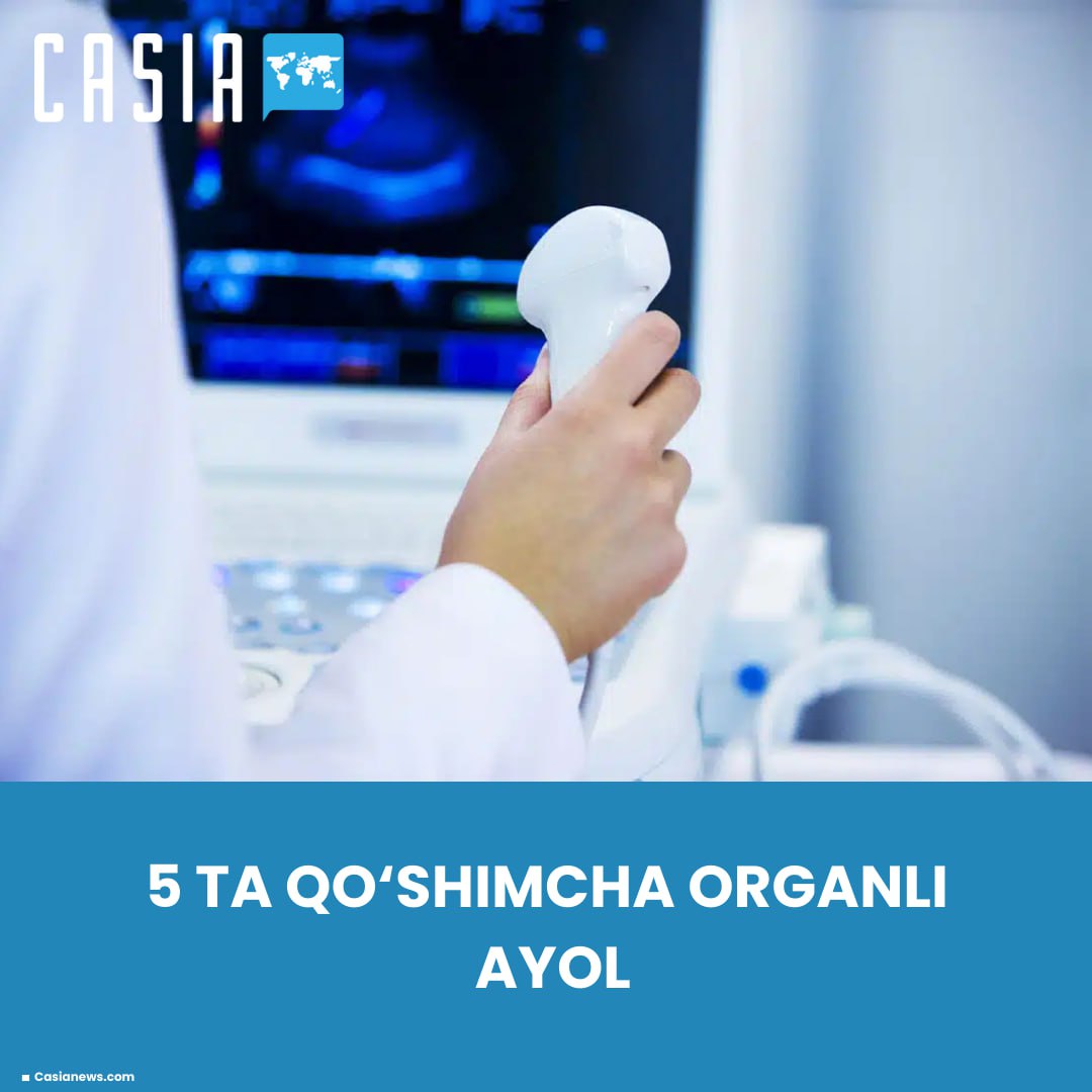 Qornida 5 ta qo‘shimcha organ aniqlangan ayol