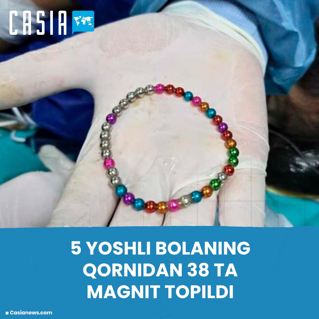 In Turkey, 38 magnetic beads were found in the intestines of a 5-year-old girl. The child swallowed a bracelet while playing with a magnetic bead.