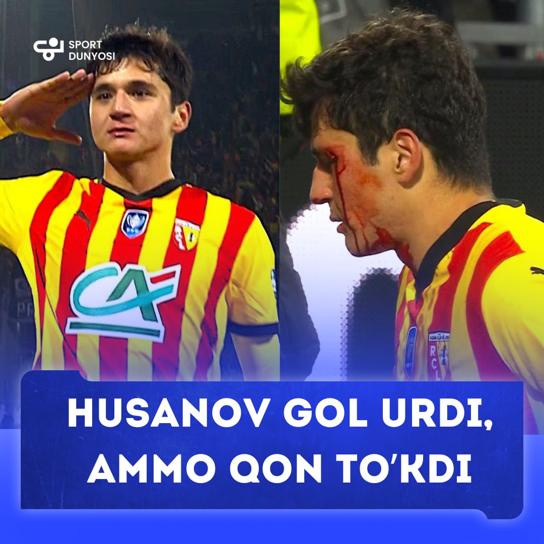 Husanov scored a goal, but he was bleeding