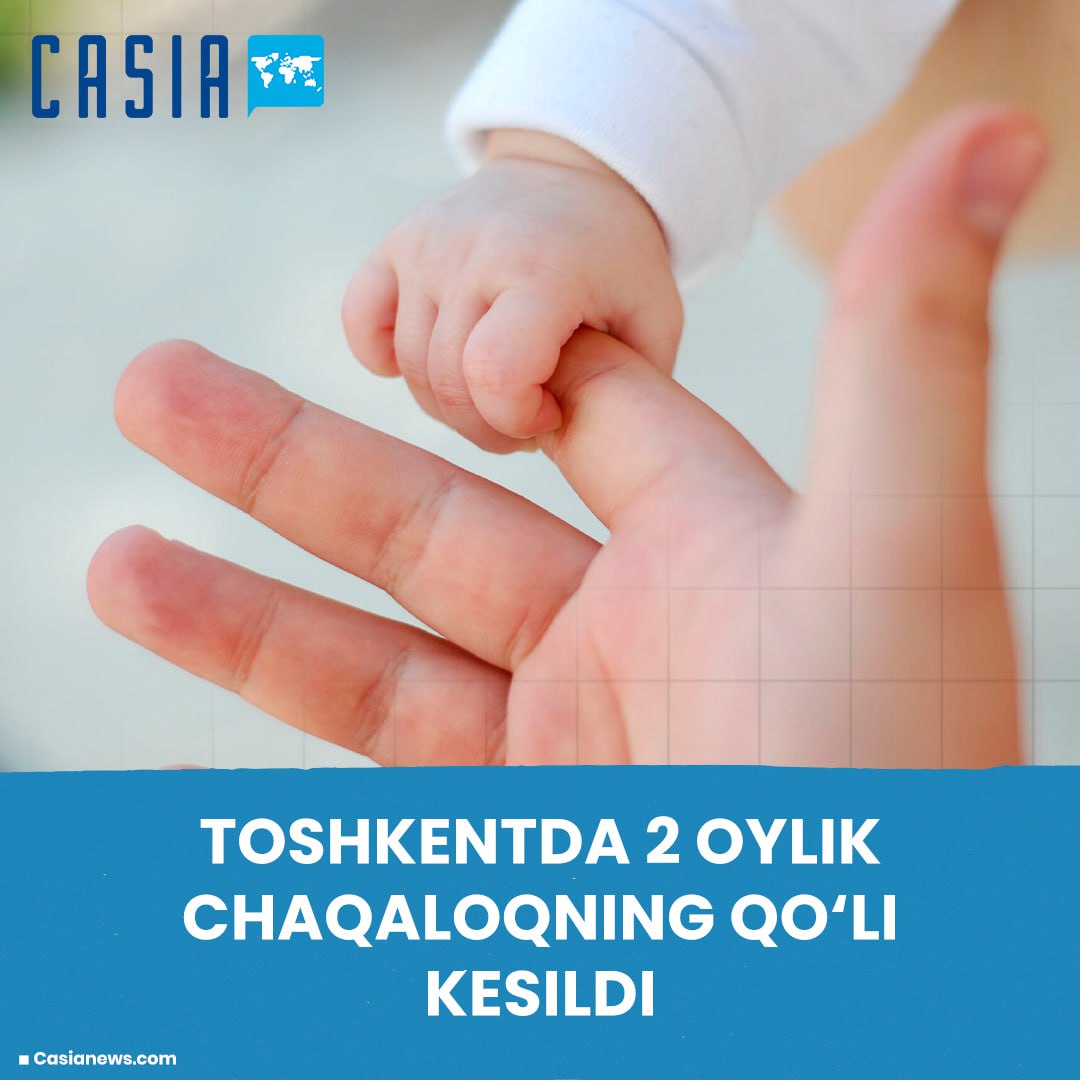 Two-month-old baby's hand amputated in Tashkent