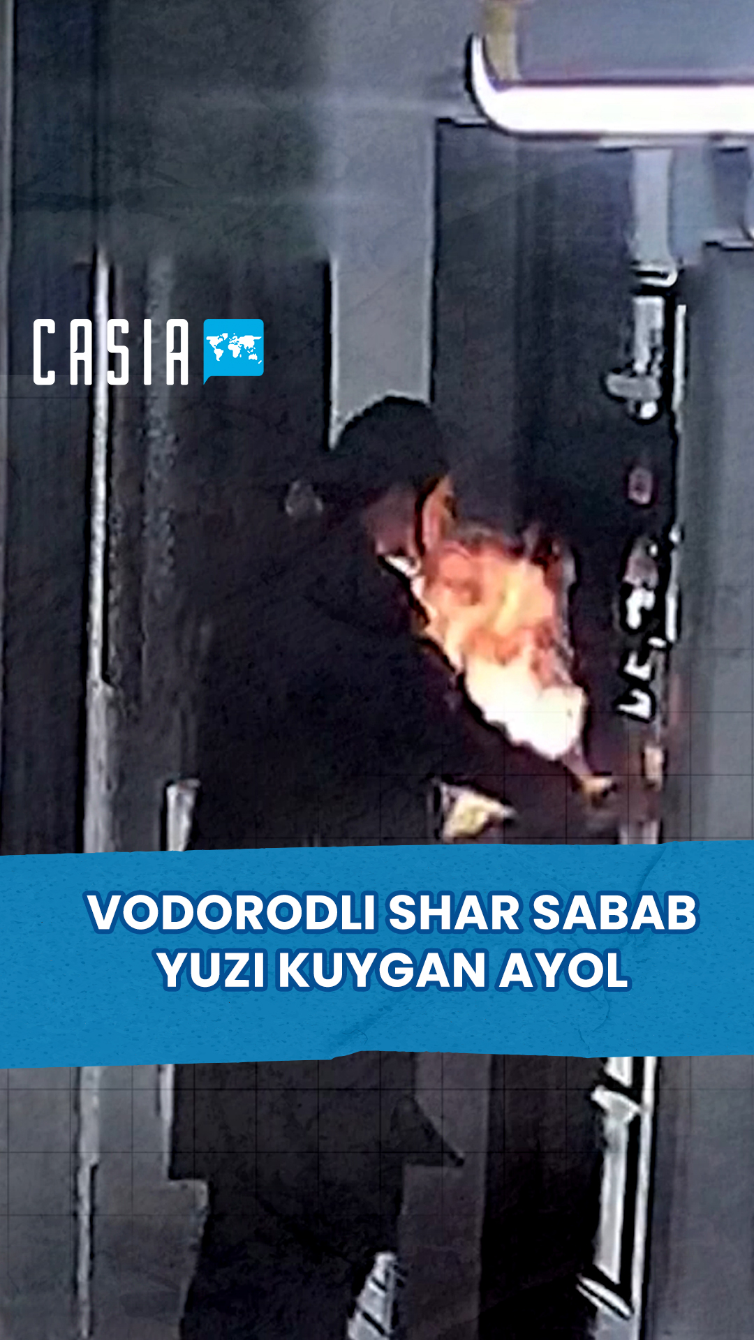 Woman Burned to Face by Hydrogen Balloon