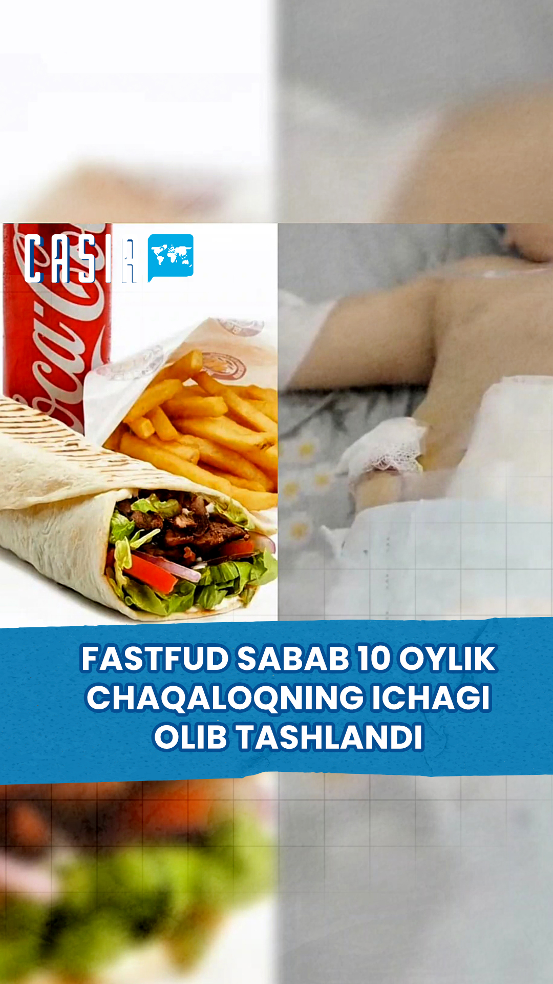 10-month-old baby's intestines removed due to fast food