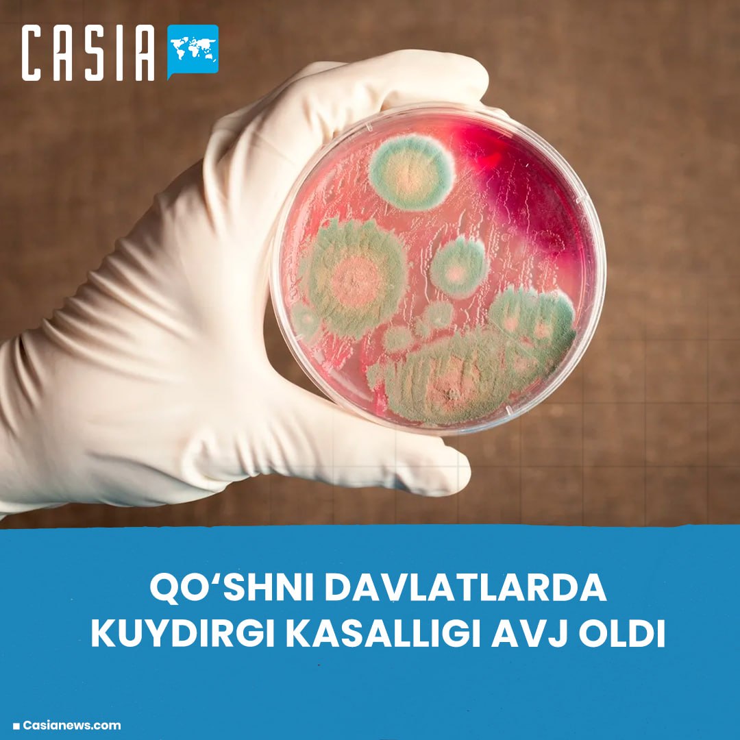 Uzbekistan tightens control over anthrax