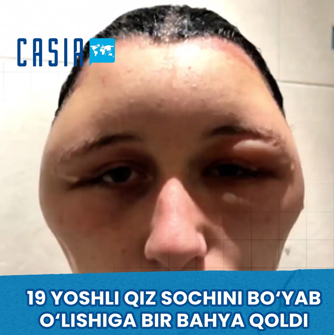Во Франции 19-летняя девушка умерла от окрашивания волос