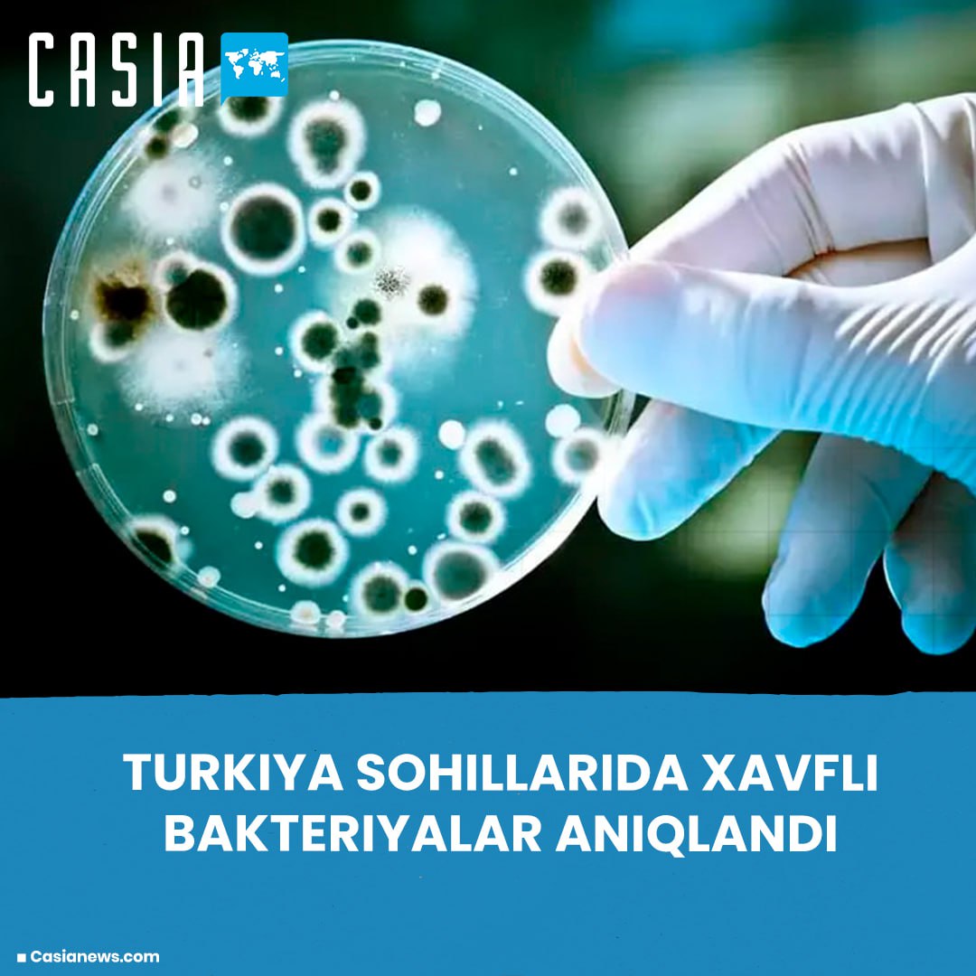In Turkey, sea water samples have been found to contain bacteria of the order vibrio, which are dangerous to human health. This is reported by the publication Milliyet.