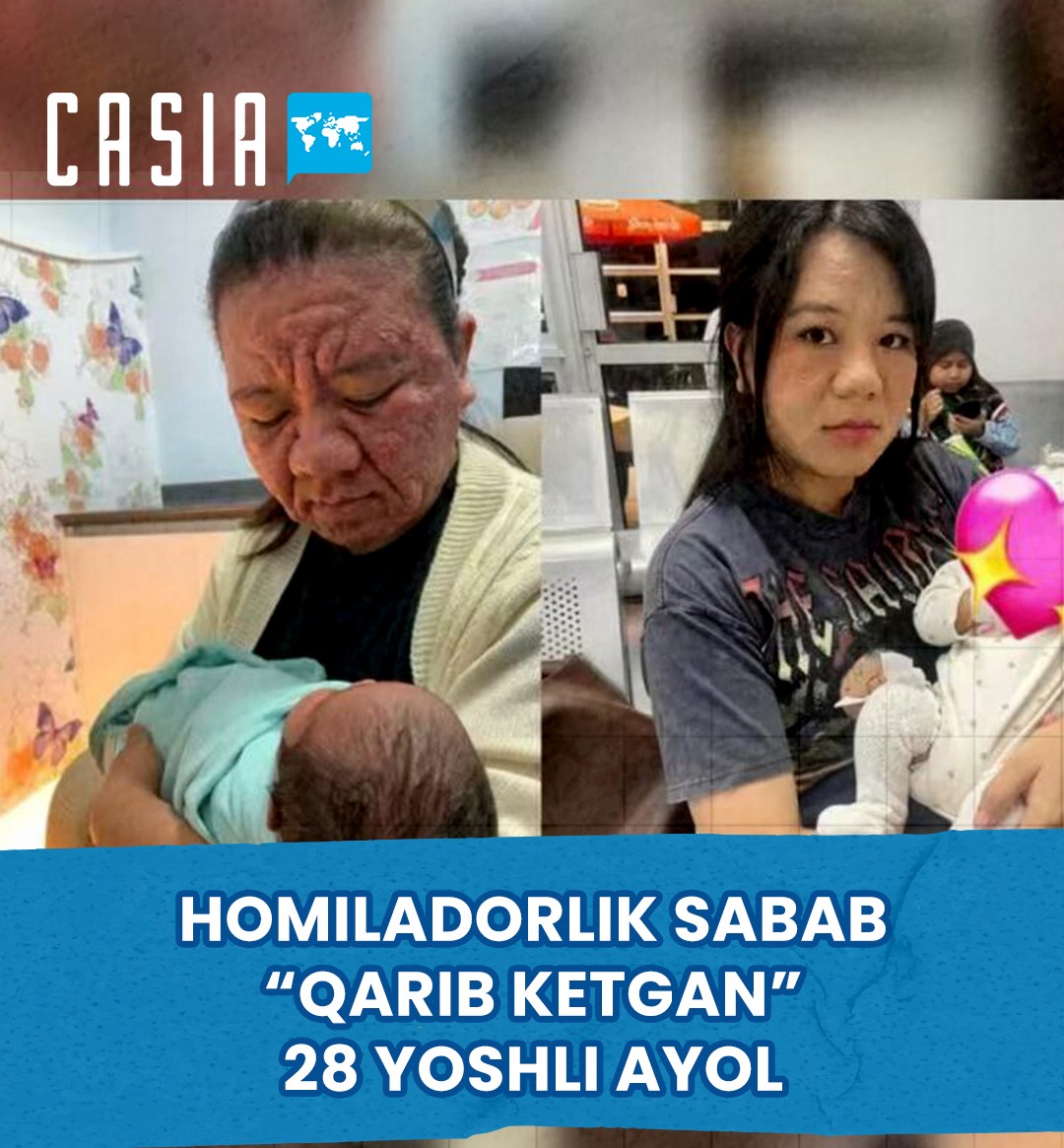 In Malaysia, a 28-year-old woman suddenly “aged”due to pregnancy