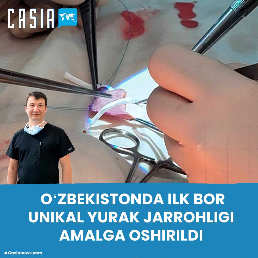 В Узбекистане проведена первая сложная операция на сердце
