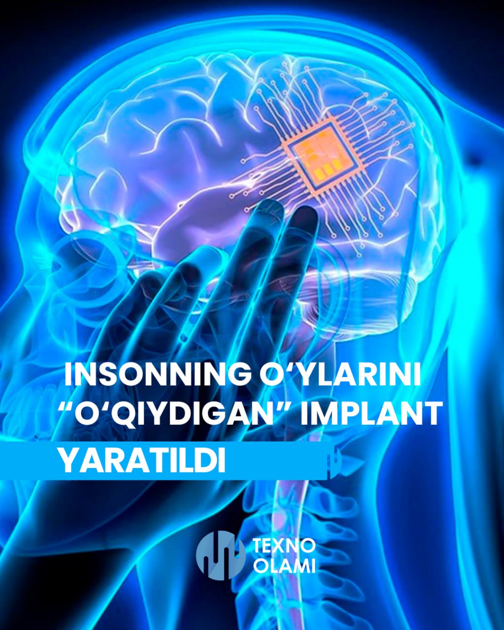 Stanford scientists have created an implant that can "read" a person's thoughts