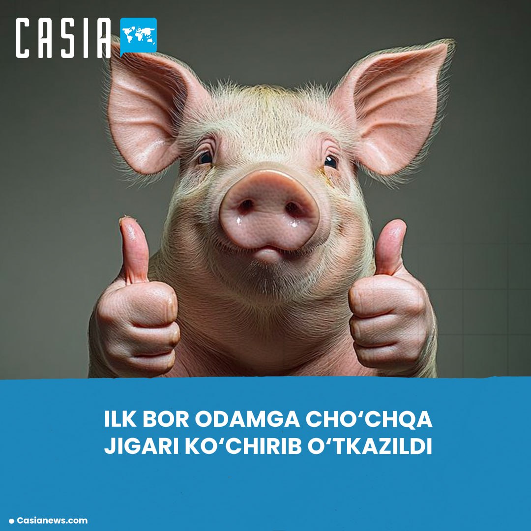 China performs world’s first pig liver transplant into a human