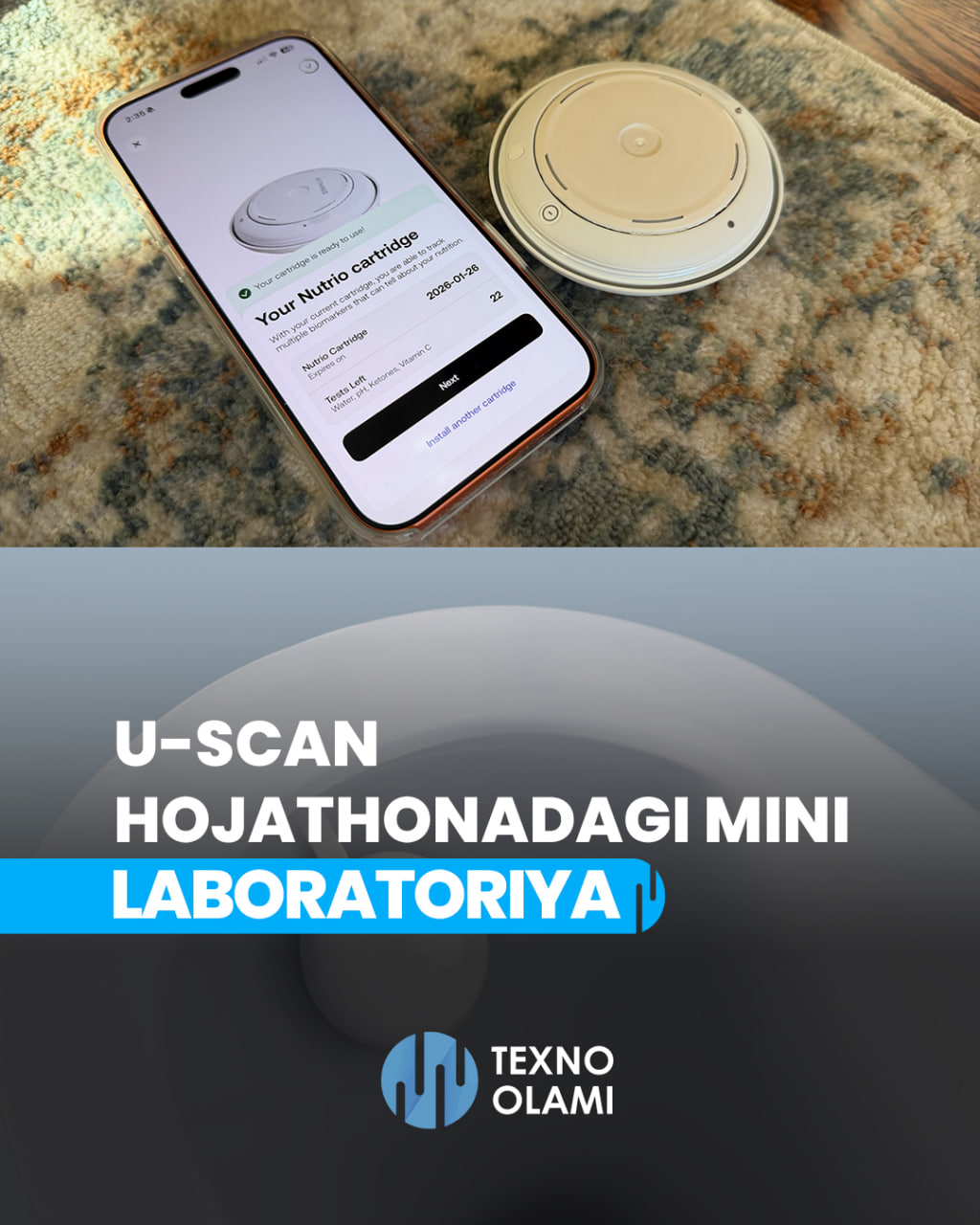 U-Scan — a mini-laboratory in your toilet