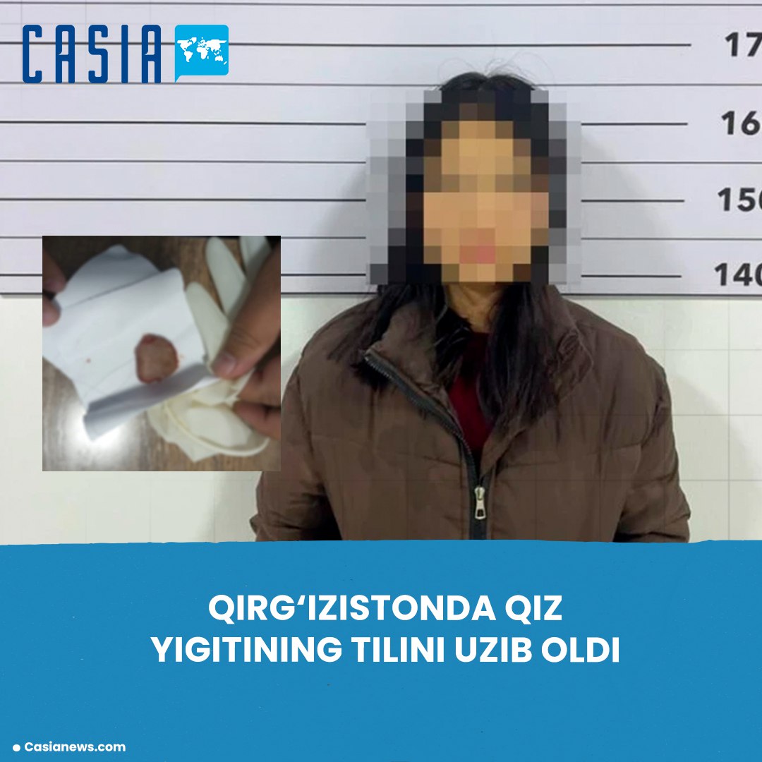 Kyrgyzstan: Girl bites boyfriend's tongue off