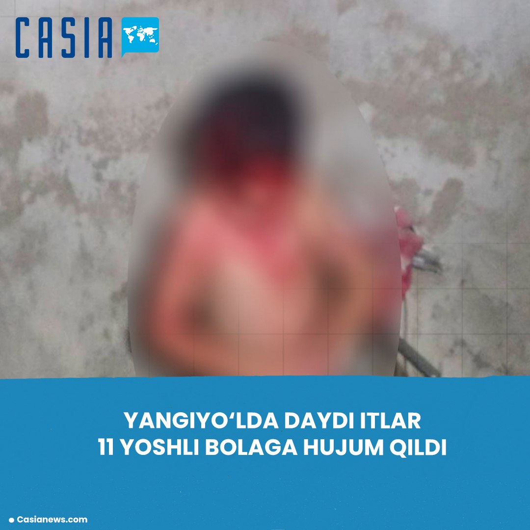 Wild dogs attack 11-year-old boy in Yangiyul