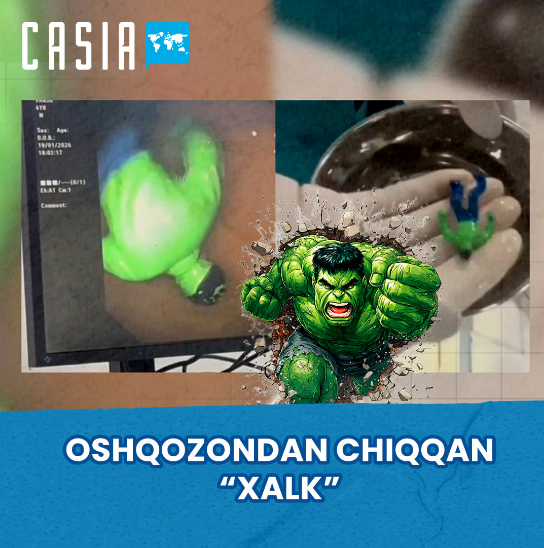 Doctors are shocked: "Hulk" came out of the stomach of a one-and-a-half-year-old boy