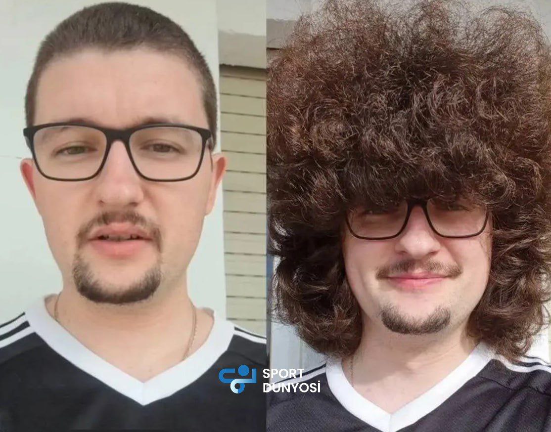 Manchester United’s 18-Month Dream Crushed Again: Frank Aylett Keeps His Hair