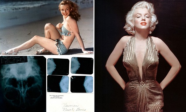 Marilyn Monroe X-rays Up for Auction