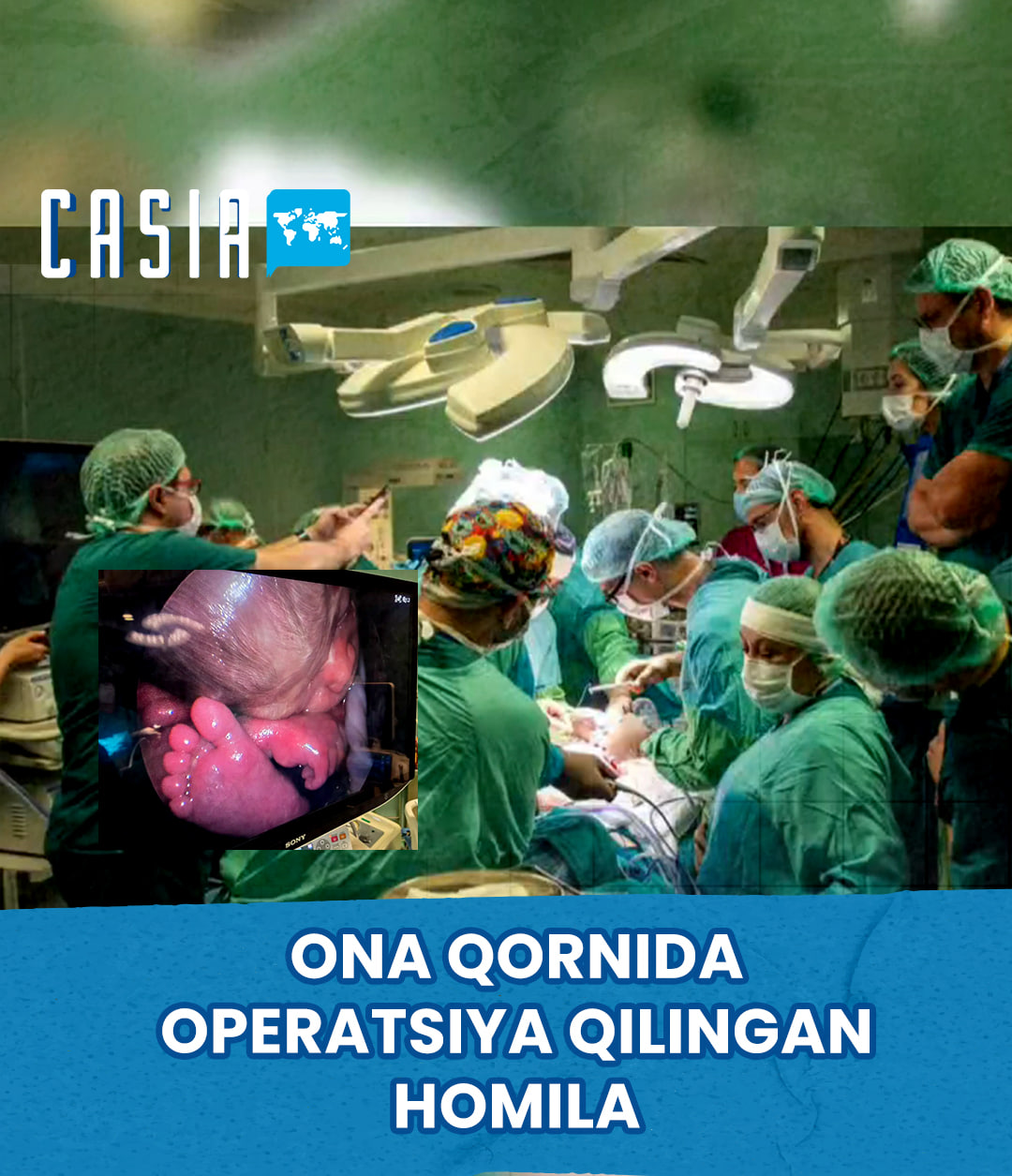 Turkey successfully performs fetal spinal surgery in the womb for the first time