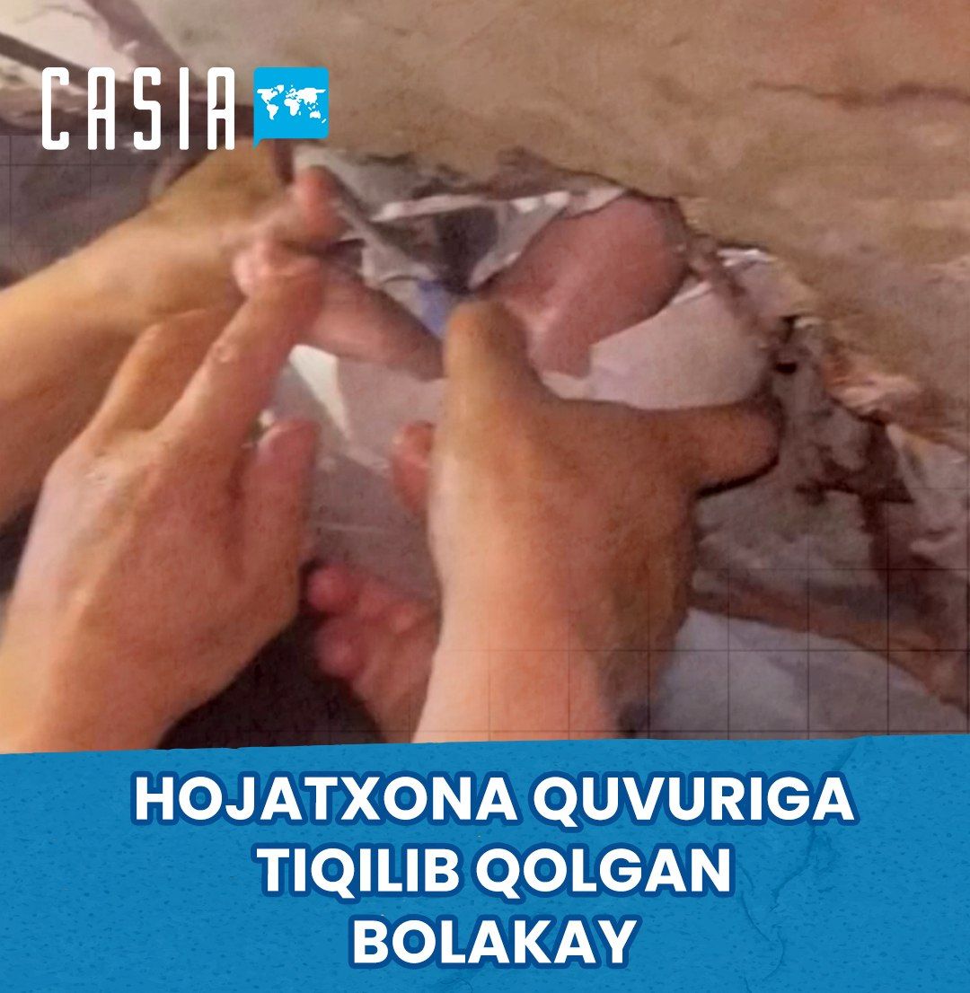 One-Year-Old Child’s Leg Gets Stuck in a Toilet Pipe