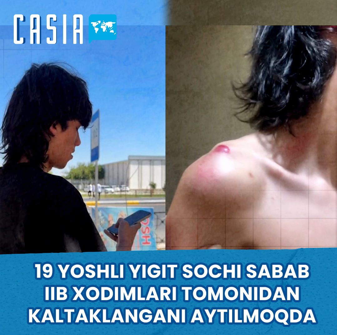 Reports emerge of a 19-year-old man in Qarshi being beaten by police officers over his long hair