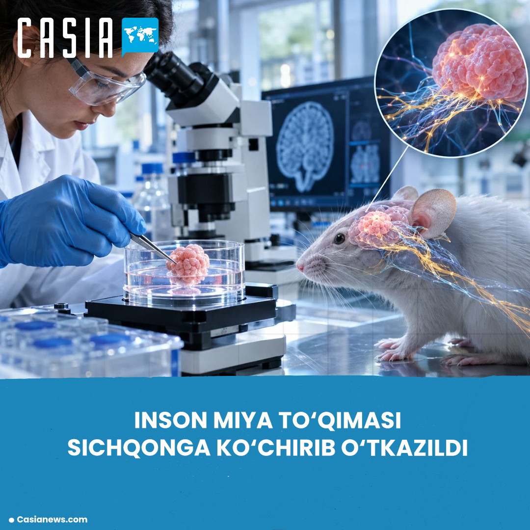 Human brain tissue transplanted into mouse brain: scientists conduct new experiment.